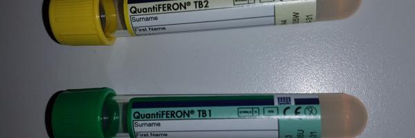 TB Quantiferon 4 tube Assay.JPG